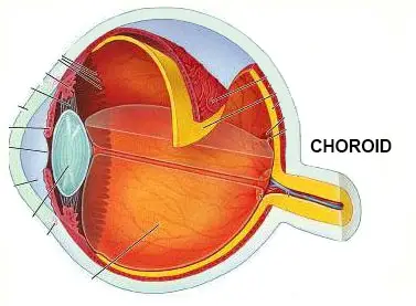 Red eye choroid tissue diagram