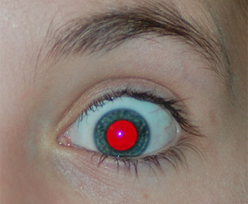 red eye example